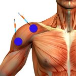 ejercicios para bíceps electrodos deltoide