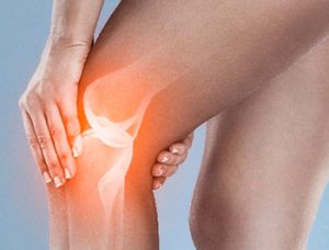 suplementos para mejorar la salud articular-rodilla